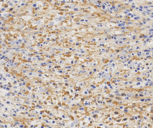 Hsp70 Recombinant antibody