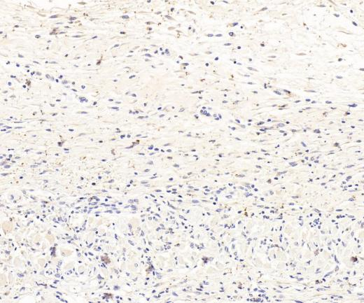 IL-10 Recombinant antibody