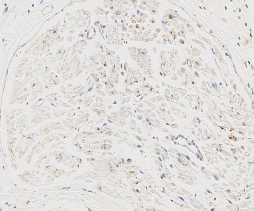 IL1beta Recombinant antibody