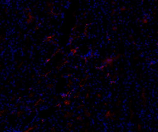 NRF2 Recombinant antibody