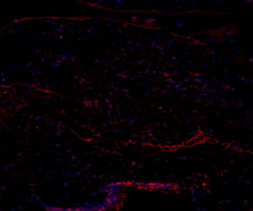 RUNX2 Recombinant antibody