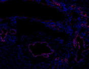 SOX9 Recombinant antibody