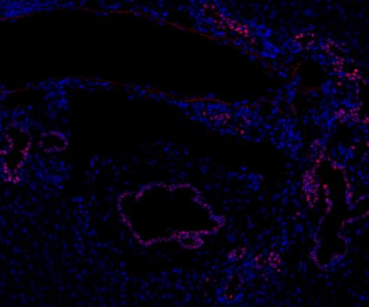 SOX9 Recombinant antibody