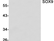 SOX9 Recombinant antibody