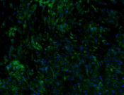 VEGFA Recombinant antibody