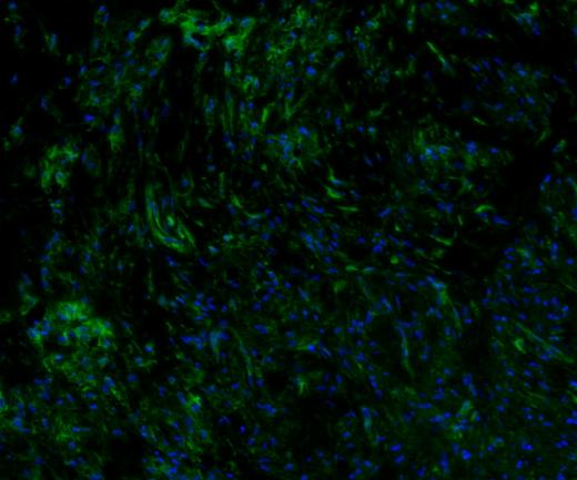 VEGFA Recombinant antibody