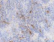 VIMENTIN Recombinant antibody