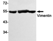 VIMENTIN Recombinant antibody