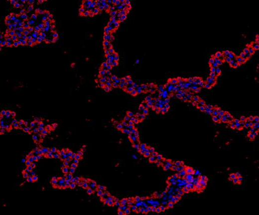 iNOS Recombinant antibody