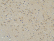 GSK3B Recombinant antibody