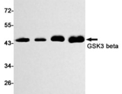 GSK3B Recombinant antibody