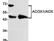 ACOX1 Recombinant antibody