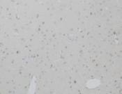 Phospho-IkB Alpha Recombinant antibody