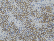 MUT Recombinant antibody