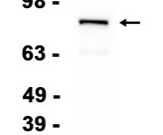 MUT Recombinant antibody