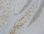 GRP78 Recombinant antibody