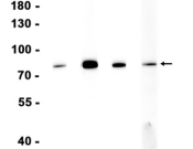 GRP78 Recombinant antibody