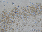 ACSL4/FACL4 Recombinant antibody
