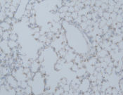 ATG5 Recombinant antibody