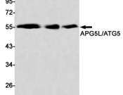 ATG5 Recombinant antibody
