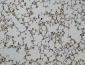 CLPX Recombinant antibody