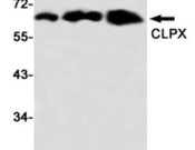 CLPX Recombinant antibody
