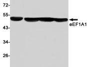 EEF1A1 Recombinant antibody