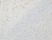 EEF1A1 Recombinant antibody