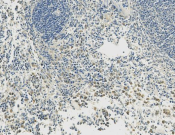 HSP90 Recombinant antibody