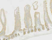 IGF2BP3 Recombinant antibody