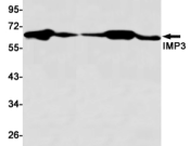 IGF2BP3 Recombinant antibody