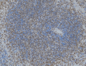 TDP-43 (C-terminal) Recombinant antibody