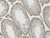 ATP5A1 Recombinant antibody