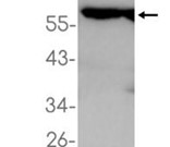 ATP5A1 Recombinant antibody