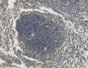 C1QBP Recombinant antibody