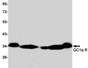 C1QBP Recombinant antibody