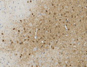 Calretinin Recombinant antibody