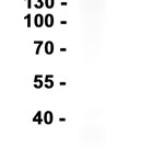 Calretinin Recombinant antibody
