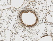 Calsequestrin 2 Recombinant antibody