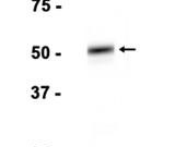 Calsequestrin 2 Recombinant antibody