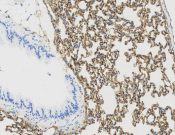 CD141 Recombinant antibody