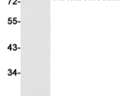 CD141 Recombinant antibody