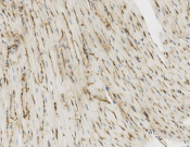 CLIC1 Recombinant antibody