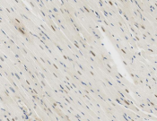 COPS8 Recombinant antibody