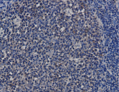 Hsp90 Recombinant antibody