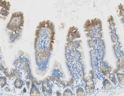 E-cadherin Recombinant antibody