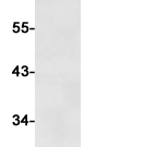 E-cadherin Recombinant antibody