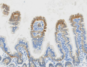 E-cadherin Recombinant antibody