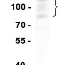 E-cadherin Recombinant antibody