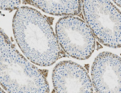 Ferritin light chain 1 Recombinant antibody